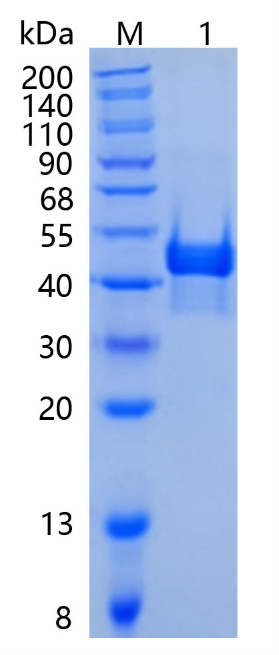 Active Recombinant Human Carbonic Anhydrase XIV / CA14 Protein