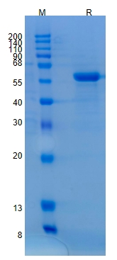 Active Recombinant Human MMP-17 / MT4-MMP Protein