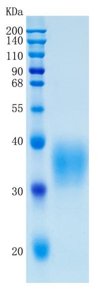 Active Recombinant Human PROCR / EPCR / CD201 Protein