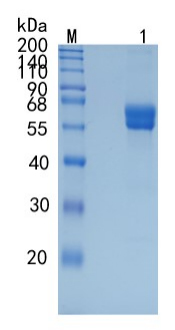 Active Recombinant Human Frizzled-1 / FZD1 Protein
