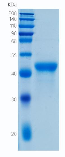 Active Recombinant Human VSIG4 / Z39Ig Protein