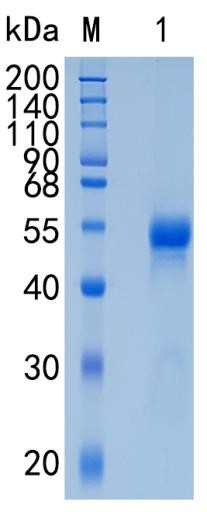 Active Recombinant Human Netrin-G1 / NTNG1 Protein