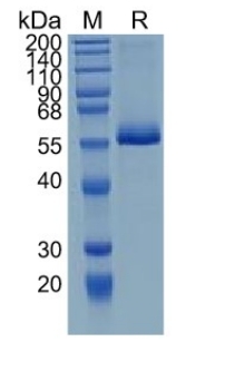 Active Recombinant Human RANK / TNFRSF11A / CD265 Protein
