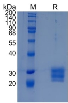 Active Recombinant Cynomolgus LAIR1 Fc Chimera Protein