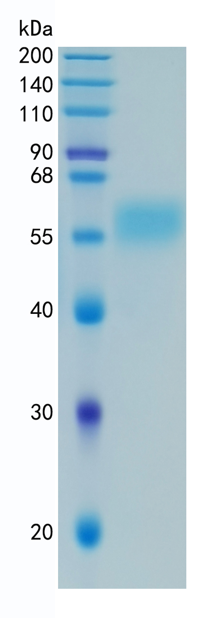 Active Recombinant Human IL-18R beta / IL-1R7 / CD218b Protein