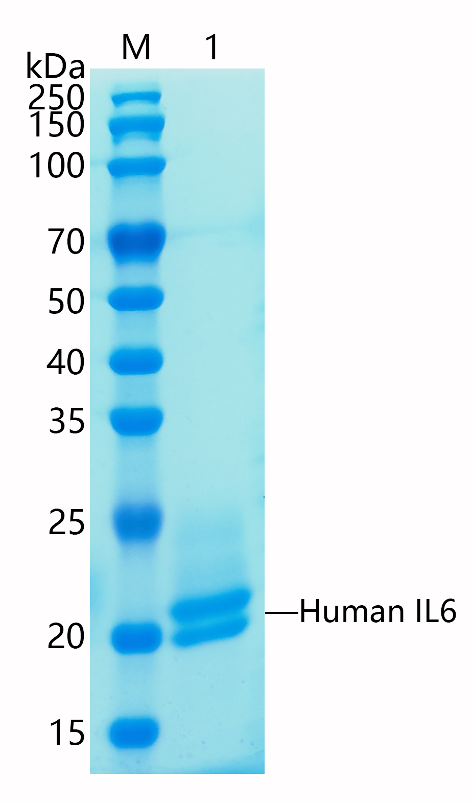 Active Recombinant Human Interleukin-6 / IL-6 Protein
