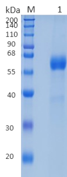 Active Recombinant Human GFR alpha-1 / GFRA1 Protein