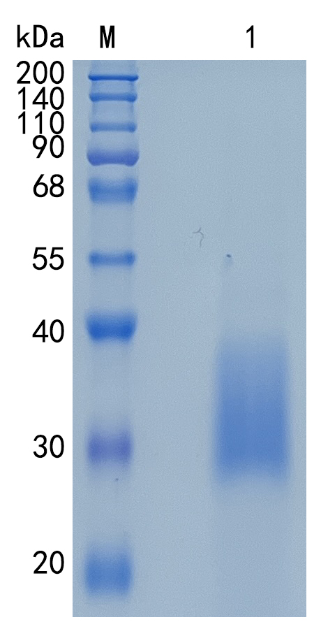 Active Recombinant Human Activin RIIB / ACVR2B Protein