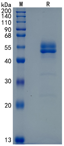 Active Recombinant Human TNFRSF19L / RELT Protein