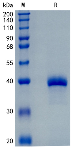 Recombinant Human Nogapendekin alfa / IL-15 Protein