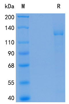 Recombinant Human OS9 / ER Lectin Protein