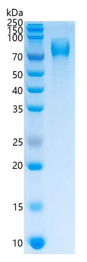 鵰 Recombinant Human Thrombopoietin / THPO / TPO / MGDF / MPLLG Protein