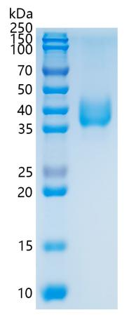 鵰 Recombinant Human CD142 / TFA / Tissue Factor / TF Protein