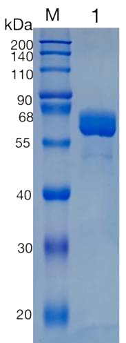 鵰 Recombinant Human Carboxylesterase 2 / CES2 / ICE Protein