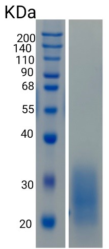 鵰 Recombinant Human CD337 / LY117 / NCR3 / NKp30 / 1C7 / MALS Protein