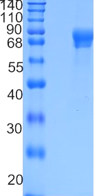 鵰 Recombinant Human FLRT2 Protein