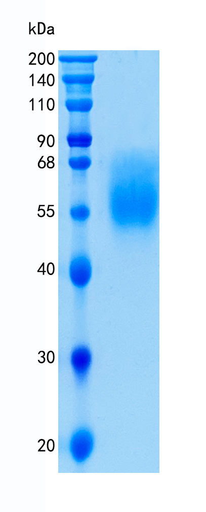 鵰 Recombinant Human SIGLEC6 / CD327 / CD33L1 / CDw327 / SIGLEC-6 Protein