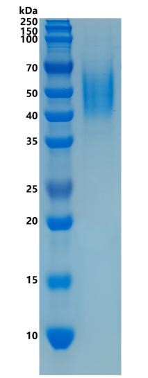 鵰 Recombinant Human CD275 / B7H2 / GL50 / ICOSL / ICOSLG / B7RP1 / LICOS / B7-H2  Protein