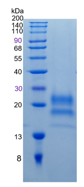 鵰 Recombinant Human Cystatin F / CMAP / LeukoCystatin / CST7 Protein