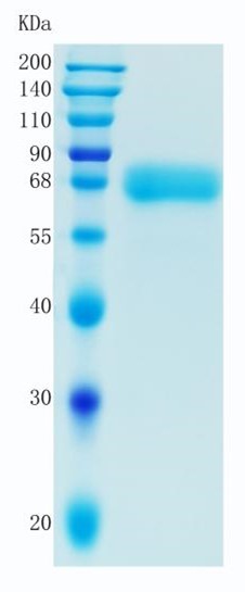 鵰 Recombinant Human GDNF Receptor alpha 2 / GFRA2 / GDNFRB / RETL2 / TRNR2 Protein