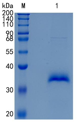 鵰 Recombinant Human FLRG / FLRGFSRP / Follistatin-like 3 / FSTL3 Protein