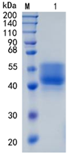 鵰 Recombinant Human FSTL1 / FRP /Follistatin-Related Protein 1 / Follistatin-Like Protein 1 Protein
