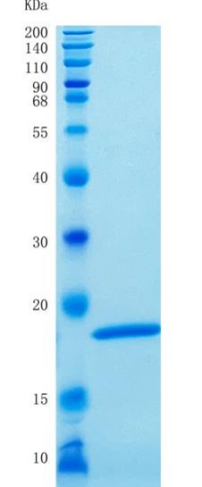 鵰 Recombinant  Human Interferon alpha 1 / IFL / IFN / IFNA13 Protein