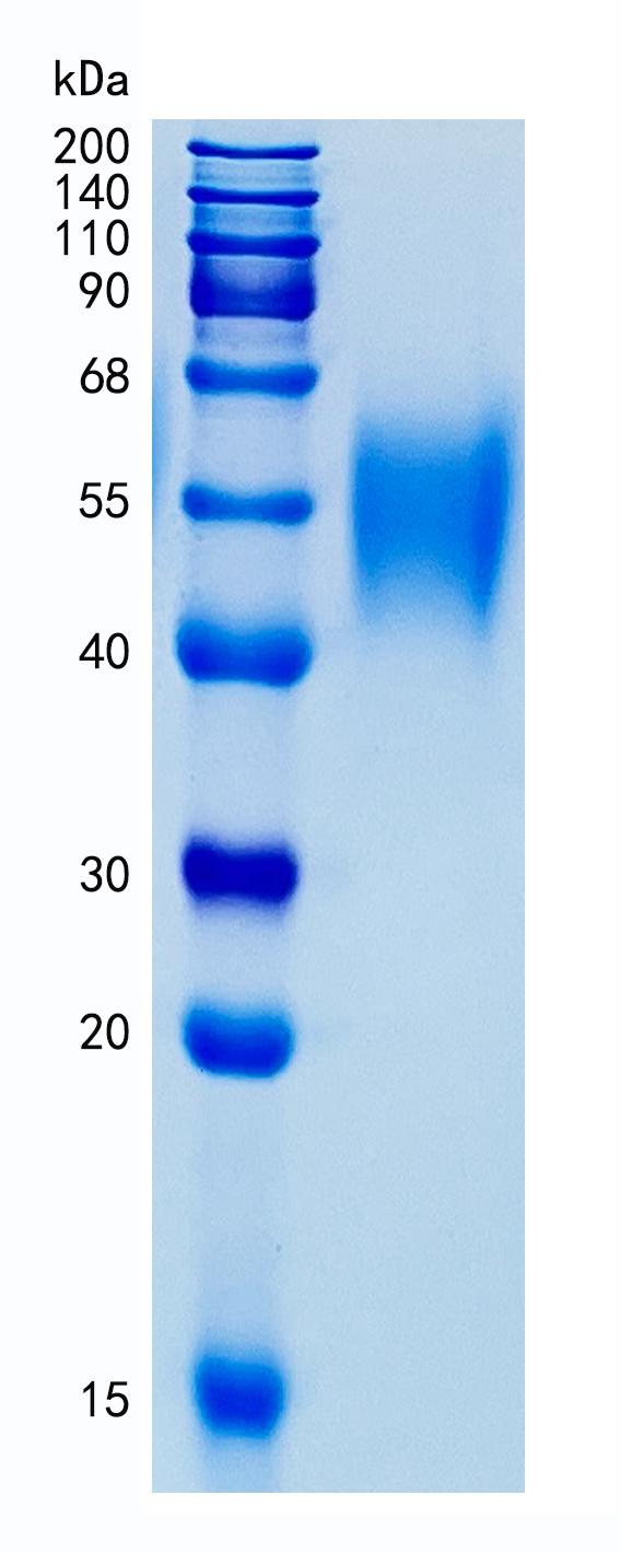 鵰 Recombinant Human SLAM/CD150 / SLAMF1 / SLAM / IPO-3  Protein