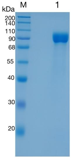 鵰 Recombinant Human Polymeric immunoglobulin receptor/PIGR MGC125361 / MGC125362 / pIgR / Poly-Ig receptor / Protein