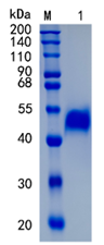 鵰 Recombinant Human Apo-H His / ApoH / B2G1 / B2GP1 Protein