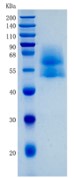 鵰 Recombinant Human TPBG / 5T4 Protein / 5T4AG Protein / M6P1 Protein