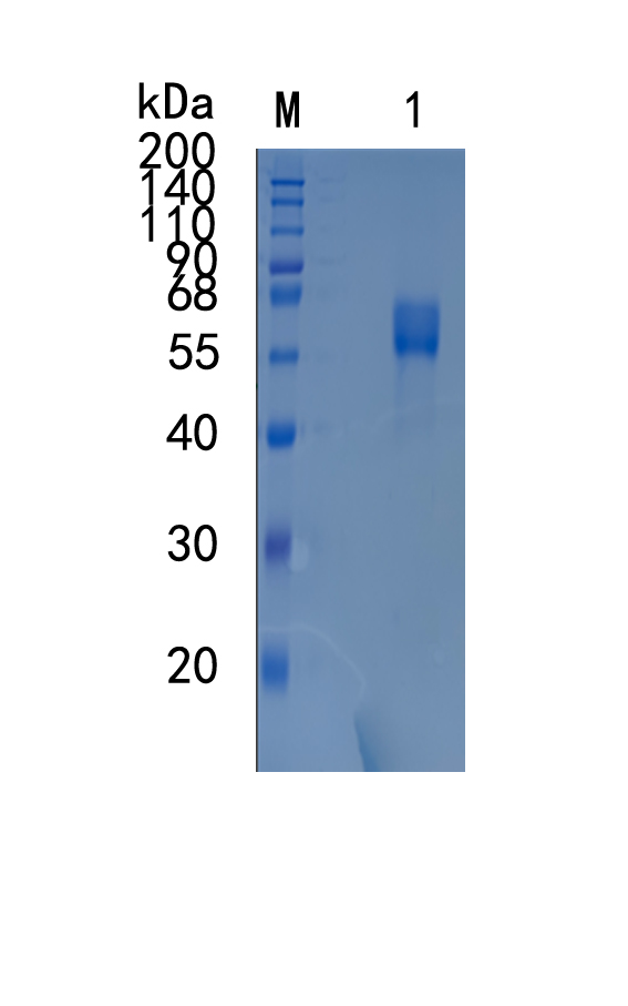 鵰 Recombinant Human  Activin RIIB / ActivinRIIB / ACTRIIB / ActR-IIB / ACVR2B Protein