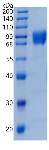 鵰 Recombinant Human IL-10 R alpha / IL-10RA / IL10RA / IL10R / IL-10R1 / IL-10R subunit 1 Protein