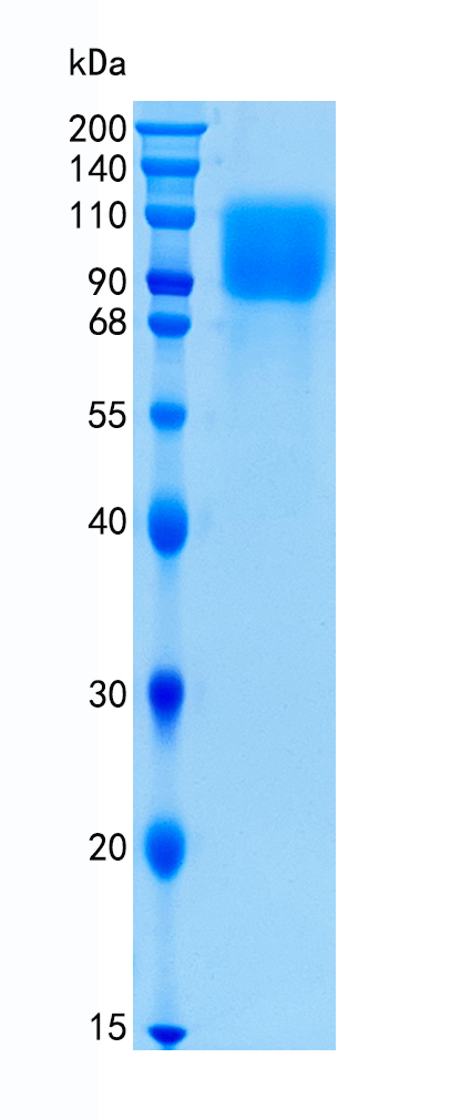 鵰 Recombinant Human Transmembrane Glycoprotein NMB / GPNMB / HGFIN / NMB Protein