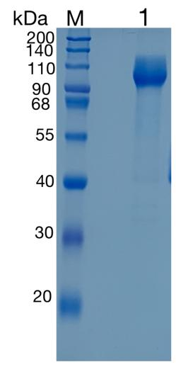 鵰 Recombinant Human TrkA / NTRK1 / MTC / TRK Protein