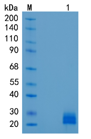 鵰 Recombinant Human Ephrin A1 / EPLG1 / TNFAIP4  Protein