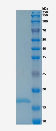鵰 Recombinant Rat SCF / sKITLG / Kitlg  Protein