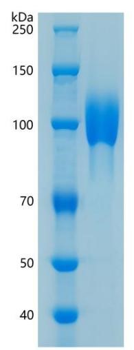 鵰 Recombinant human FGFR2 / ECT1 / TK14 / TK25   Protein
