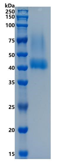 鵰 Recombinant Human Biglycan / BGN / SLRR1A  Protein