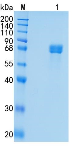鵰 Recombinant Human  Acetylcholinesterase / N-ACHE / Yt blood group  Protein