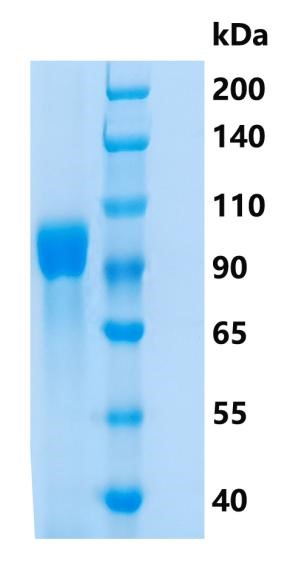 鵰 Recombinant Human FGFR4 / CD334 / JTK2 / TKF  Protein