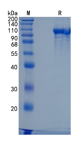 鵰 Recombinant Human E-NPP 2 / ENPP2 / LysoPLD / NPP2 / PD-IALPHA / PDNP2 / PDNP2NPP2 Protein