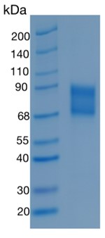 鵰 Recombinant Mouse TNF RII/TNFRSF1B /  TNF-RII / TNFRII  Protein