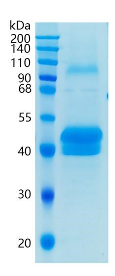 鵰 Recombinant Human Pentraxin 3/PTX3 / PTX3 / TNFAIP5 / TSG14  Protein