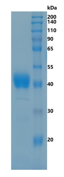 鵰 Recombinant  Human Zinc Alpha 2 Glyco protein / ZNGP1 / ZA2G  Protein