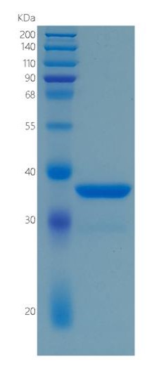 鵰 Recombinant Human Liver Arginase / His / ARG2 / Arginase-2 Protein