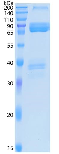 鵰 Recombinant  Human RAGE / rHuAGER, His /  RAGE / AGER Protein