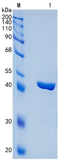 鵰 Recombinant Human Chitinase 3-like 2 / YKL39 / CHI3L2  Protein