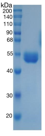 鵰 Recombinant Mouse Renin /FLJ10761 / HNFJ2 / Prorenin / REN Protein