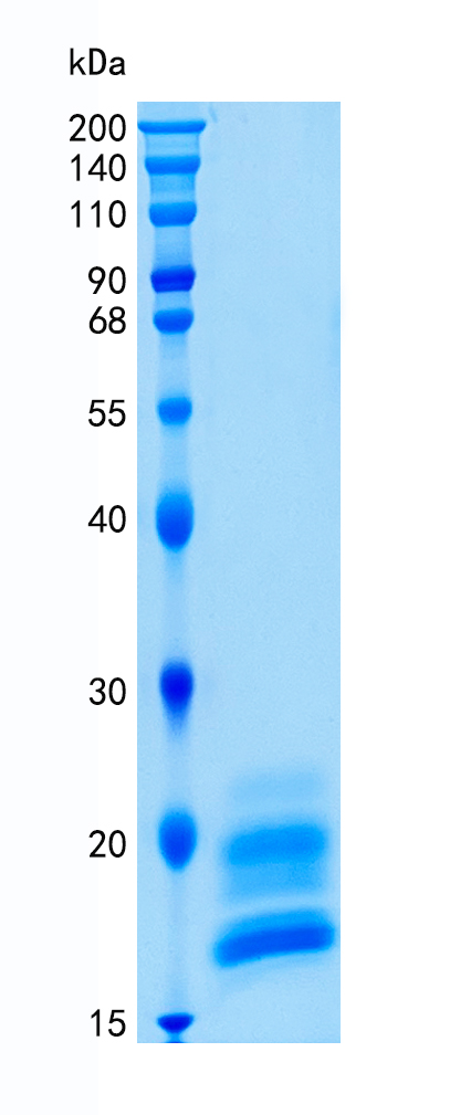 鵰 Recombinant Human IL-17A/F Heterodimer IL-17 /  IL-17F / IL24; ML-1  Protein